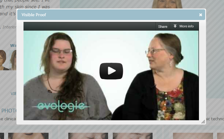 Evologie Custom Video Module Evologie Custom Video Module