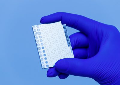 600-medical-blood-blue-glove-holding-test-product-chip